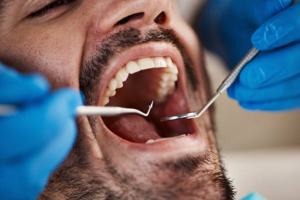Best Dental X-Rays and Imaging  in Newtown, OH